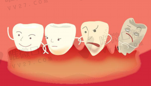 烤瓷牙与活动假牙的区别,烤瓷牙和全瓷牙区别(图1)